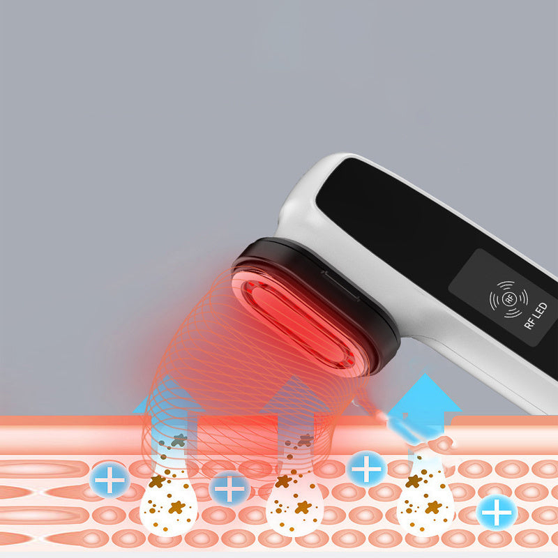 Electric Current Thermal Magi Face Lift Tensioner